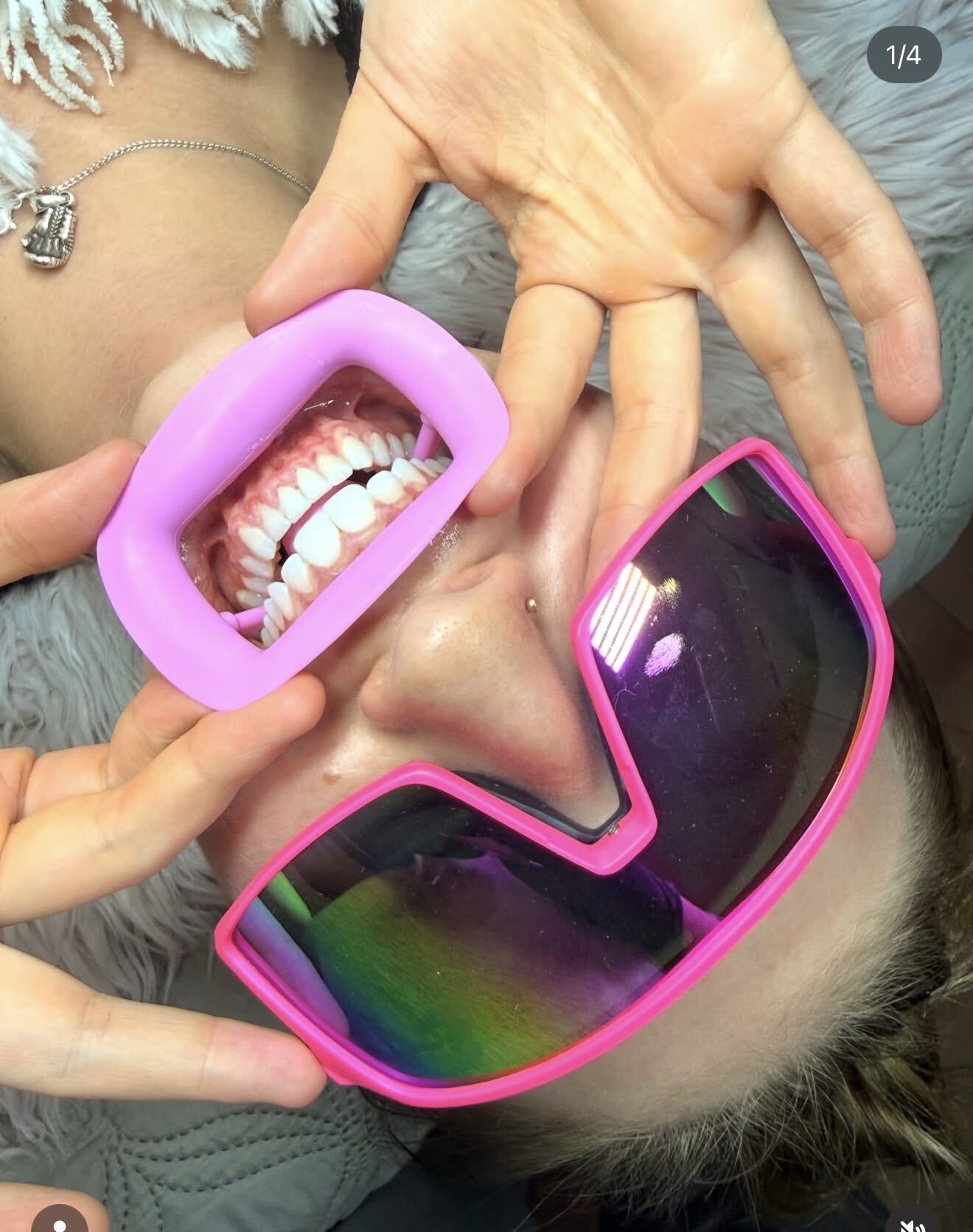 Client during a teeth whitening session wearing pink protective glasses